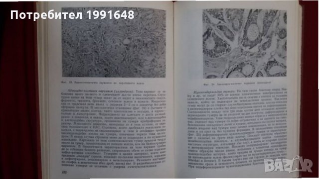 Книги за медицина: „Патология и биология на злокачествените тумори“ – проф.Райчо Райчев, снимка 10 - Учебници, учебни тетрадки - 23925464