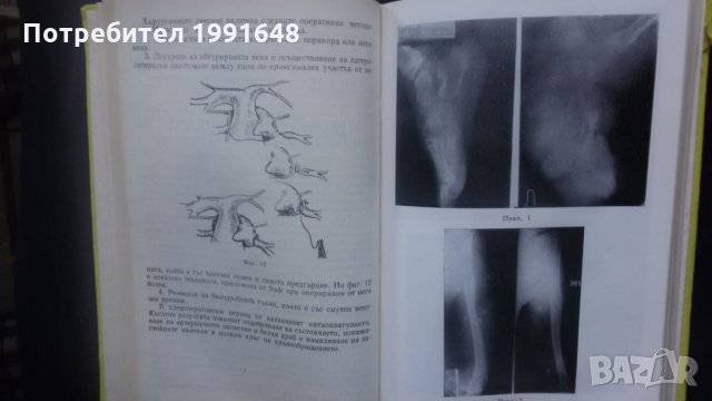 Книги за медицина: „Вродени пороци на кръвоносните съдове“ – доц. Стефан Белов, к.м.н., снимка 13 - Специализирана литература - 24403001