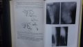Книги за медицина: „Вродени пороци на кръвоносните съдове“ – доц. Стефан Белов, к.м.н., снимка 13