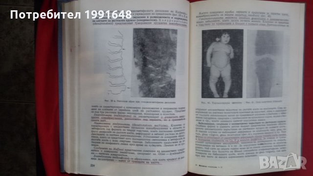 Книги за медицина: „Клинична педиатрия“ 2 част – проф. Бр.Братанов – народен деятел на науката, снимка 17 - Учебници, учебни тетрадки - 23999681