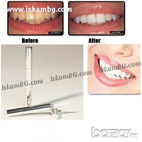 Писалка за избелване на зъби - код 0745, снимка 4 - Други стоки за дома - 13515765