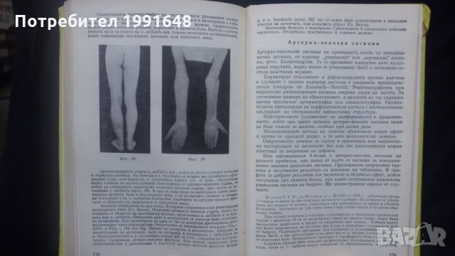 Книги за медицина: „Вродени пороци на кръвоносните съдове“ – доц. Стефан Белов, к.м.н., снимка 18 - Специализирана литература - 24403001