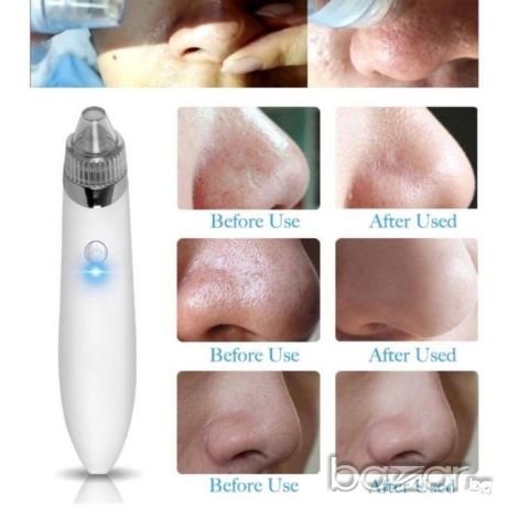 Топ цена! Нов вакуум уред за почистване на лице с 4 приставки модел XN-8030, снимка 3 - Масажори - 21035431