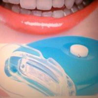  Уред за Професионално Лед избелване на зъби, снимка 2 - Други - 23661059