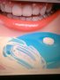 Уред за Професионално Лед избелване на зъби, снимка 2