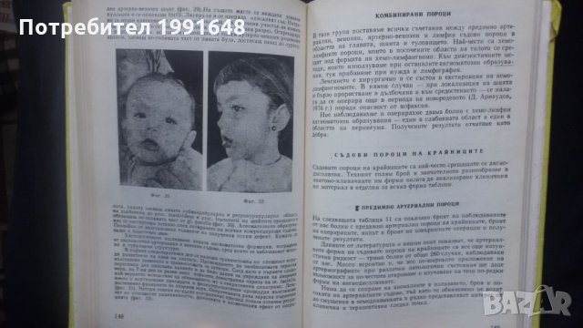 Книги за медицина: „Вродени пороци на кръвоносните съдове“ – доц. Стефан Белов, к.м.н., снимка 16 - Специализирана литература - 24403001