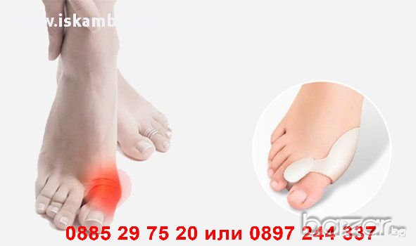 Силиконов разделител за кокалче на крака - код ДВОЕН, снимка 2 - Други - 12394495