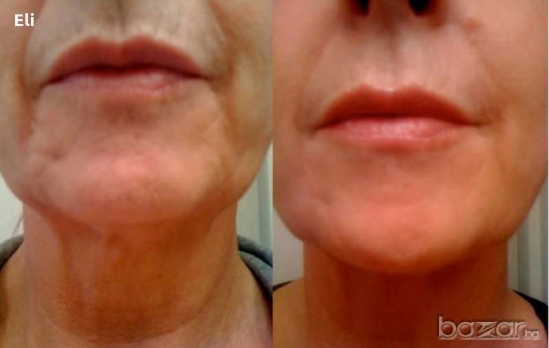 Домашен крем против бръчки с фантастичен ефект за 7 дни!, снимка 1