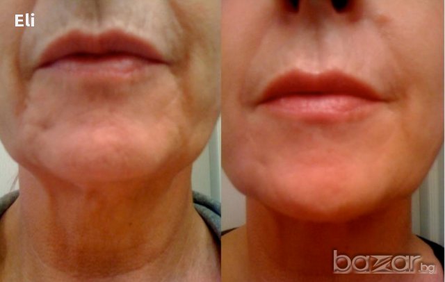 Домашен крем против бръчки с фантастичен ефект за 7 дни!