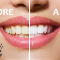 Избелване на зъби Diamond Smiles Coco Органичен Активен въглен на прах Блестяща и Неустоима Усмивка!, снимка 2 - Други - 18472800