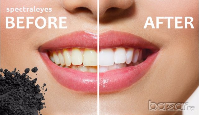 Избелване на зъби Diamond Smiles Coco Органичен Активен въглен на прах Блестяща и Неустоима Усмивка!, снимка 2 - Други - 18472800
