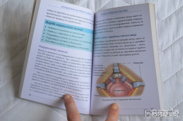 Незадържане на урината у жените - Какво трябва да знаем за проблема, снимка 3 - Специализирана литература - 23431878