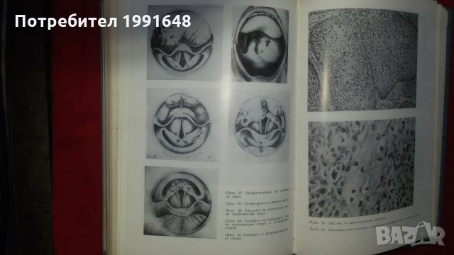 Книги за медицина: "Злокачествени новообразувания" учебник за студенти по медицина , снимка 12 - Учебници, учебни тетрадки - 22182009