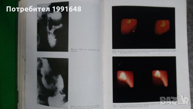 Книги за медицина: „Ръководство по вътрешни болести“ II том – под редакцията на акад.Т.Ташев и др., снимка 10 - Учебници, учебни тетрадки - 23038865