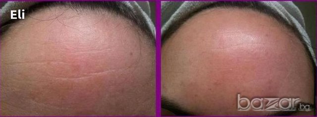 Домашен крем против бръчки с фантастичен ефект за 7 дни!, снимка 2 - Козметика - 14390632