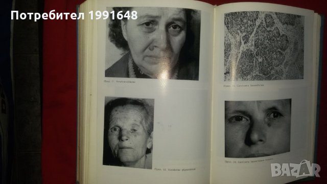 Книги за медицина: "Злокачествени новообразувания" учебник за студенти по медицина , снимка 13 - Учебници, учебни тетрадки - 22182009