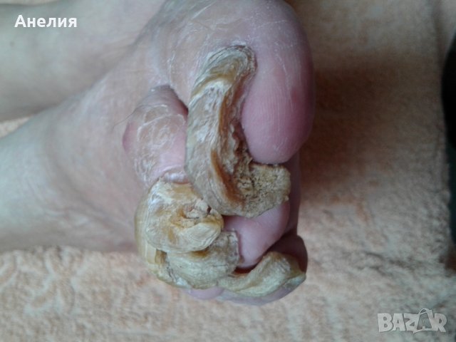 Медицински педикюр по домовете , снимка 2 - Медицински, стоматологични - 24454918