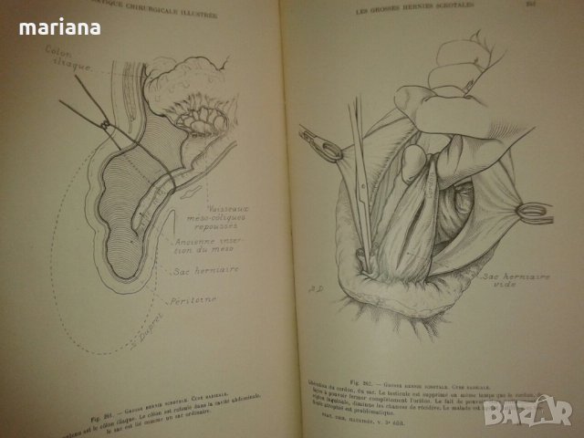 La Pratique Chirurgicale Illustree за бъдещи хирурзи на френски език, снимка 3 - Специализирана литература - 25819887