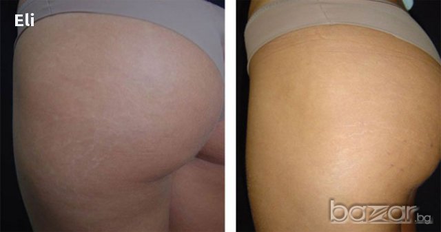 Крем против стрии с какаово масло, снимка 2 - Козметика за тяло - 11697221