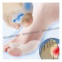 Силиконов разделител за кокалче на крака - код FOOTMATE, снимка 7