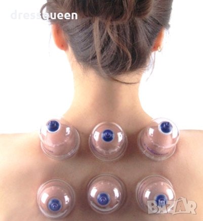 1104 Вендузи за антицелолитен масаж и вакуумна терапия, снимка 5 - Масажори - 24814840