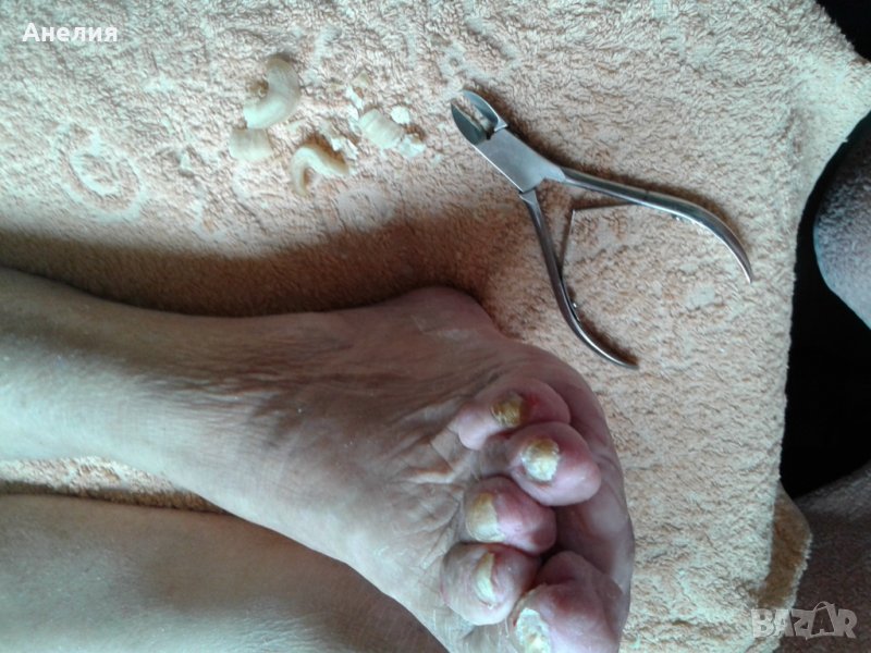 Медицински педикюр по домовете , снимка 1