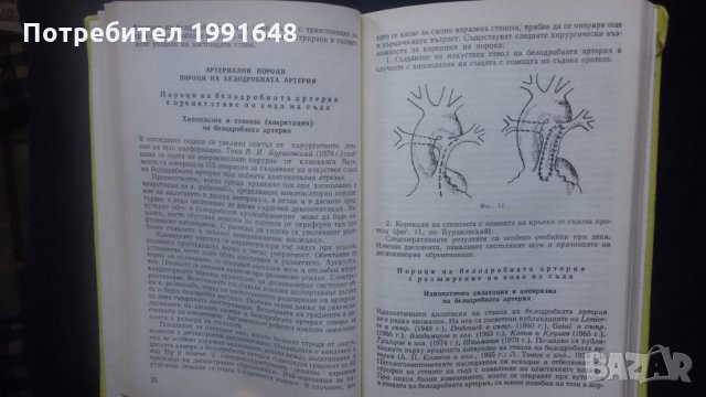 Книги за медицина: „Вродени пороци на кръвоносните съдове“ – доц. Стефан Белов, к.м.н., снимка 12 - Специализирана литература - 24403001