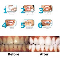  Ленти Advanced Teeht Whitening - 7-дневен курс за избелване на зъбите -без болка и дискомфорт, снимка 2 - Здраве и красота - 19647041