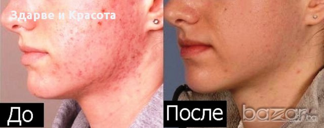 Крем мелкфет с екстракт от невен - 250мл. от Dr. Förster, Germany+подарък , снимка 4 - Козметика за тяло - 11294366