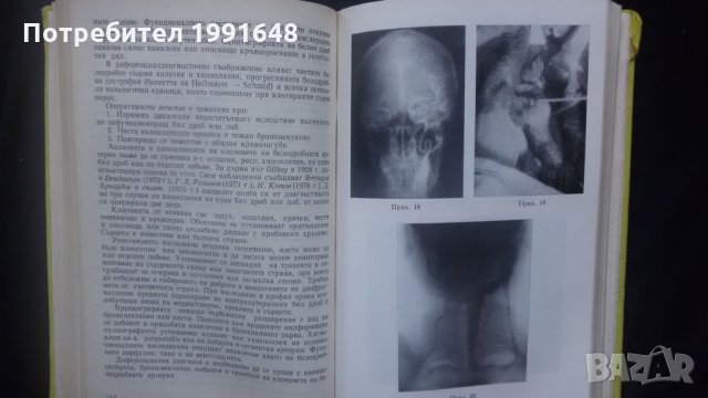 Книги за медицина: „Вродени пороци на кръвоносните съдове“ – доц. Стефан Белов, к.м.н., снимка 15 - Специализирана литература - 24403001