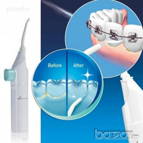 иригатор - почиства с вода венци,брекети,зъби, снимка 2 - Други - 17980102