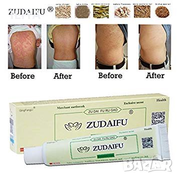 ZUDAIFU крем за псориазис, екземи, дерматити, гъбички и др, снимка 1
