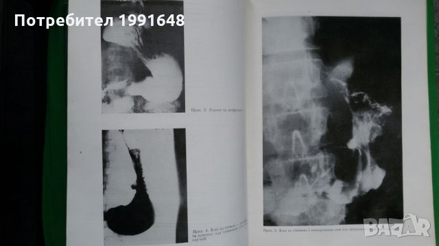 Книги за медицина: „Ръководство по вътрешни болести“ II том – под редакцията на акад.Т.Ташев и др., снимка 9 - Учебници, учебни тетрадки - 23038865