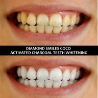 Избелване на зъби Diamond Smiles Coco Органичен Активен въглен на прах Блестяща и Неустоима Усмивка!, снимка 3 - Други - 18472800