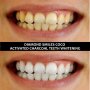 Избелване на зъби Diamond Smiles Coco Органичен Активен въглен на прах Блестяща и Неустоима Усмивка!, снимка 3