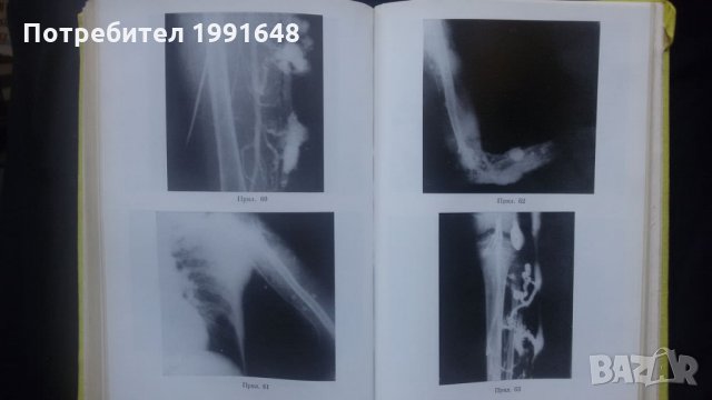 Книги за медицина: „Вродени пороци на кръвоносните съдове“ – доц. Стефан Белов, к.м.н., снимка 17 - Специализирана литература - 24403001