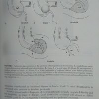Diverticular Disease Management of the difficult surgical case 1998 г. , снимка 3 - Специализирана литература - 26025495