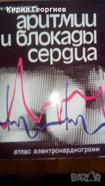 Аритмии и блокадьи сердца  Атлас електрокардиограмм, снимка 1