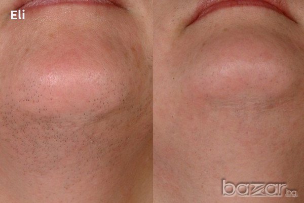 Пилинг,намаляващ окосмяването по лицето и тялото, снимка 2 - Козметика за тяло - 18741979