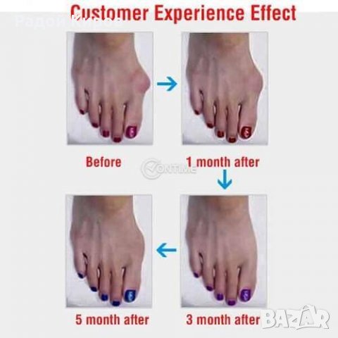 Олекотена нощна ортеза с подвижен механизъм за палеца на крака, снимка 7 - Други - 22817296