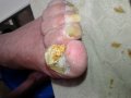 Медицински педикюр по домовете , снимка 13