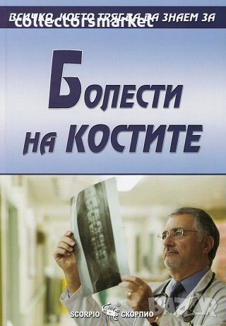 Болести по костите, снимка 1