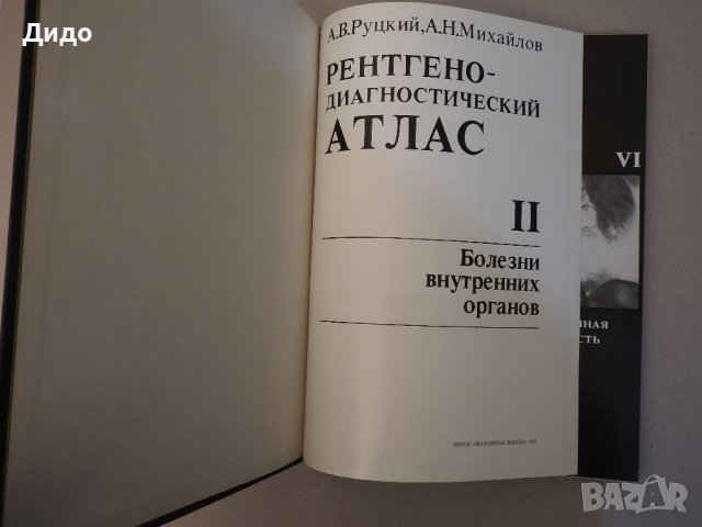 Рентгенодиагнистический атлас. Том 2: Болезни внутренних органов, снимка 2 - Специализирана литература - 39227598