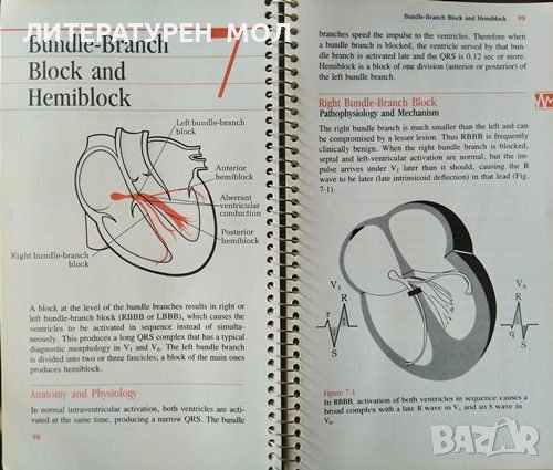 Pocket Guide to Electrocardiography. Revised Edition. Mary Boudreau Conover 1986 г. 367 illustration, снимка 2 - Специализирана литература - 37691834