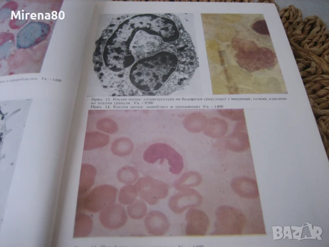 Клинична хематология - 1984 г., снимка 5 - Специализирана литература - 50674998
