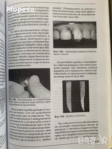 Кариесология и оперативно зъболечение, снимка 5 - Специализирана литература - 52863911