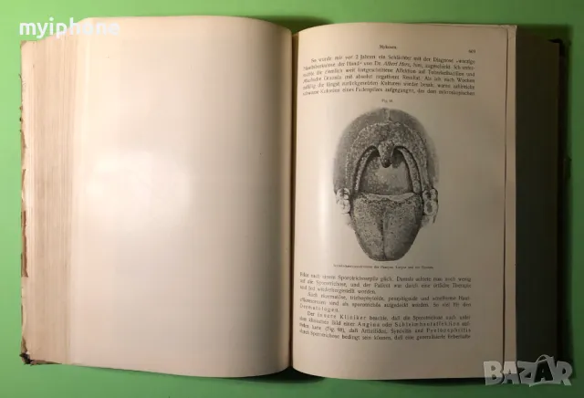 Стара Книга Патология и Лечение на Инфекциозни Болести 2 част 1919 г./1271 страници, снимка 10 - Специализирана литература - 49160295