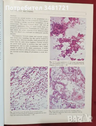 Диагностичен справочник на тумори на централната нервна система / Diagnostic Manual of Tumours, снимка 5 - Специализирана литература - 48272919