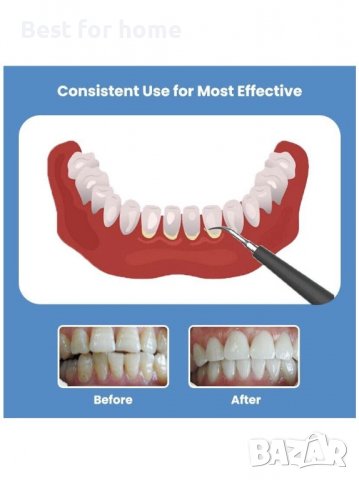 Ултразвуков уред за грижа за зъбите- за премахване на зъбен камък, снимка 5 - Стоматология - 39974065
