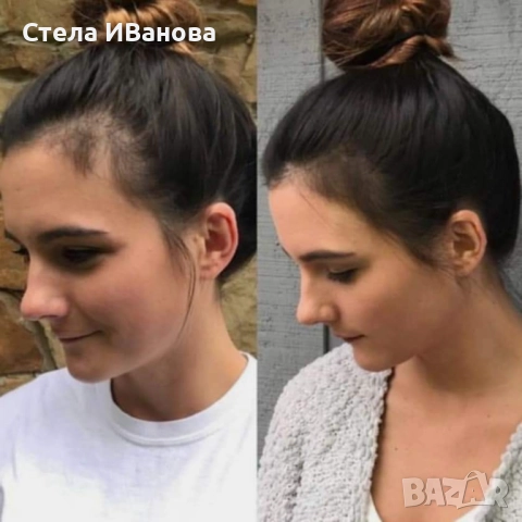 Комплект за бърз растеж на косата, косопад, оплешивяване, Bio Rehab промоция, снимка 6 - Продукти за коса - 51740673